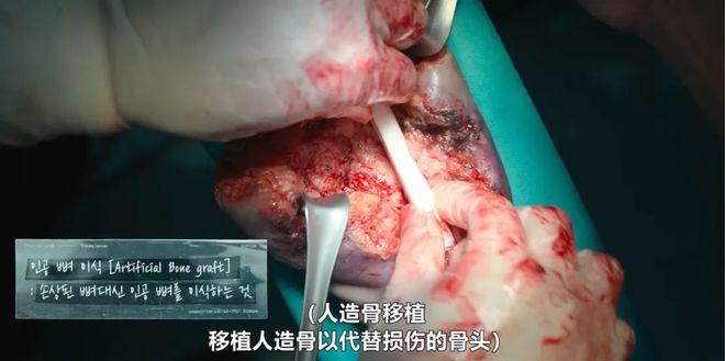 国产医疗剧想出经典，先学会“抄作业”-第7张图片-ZBLOG